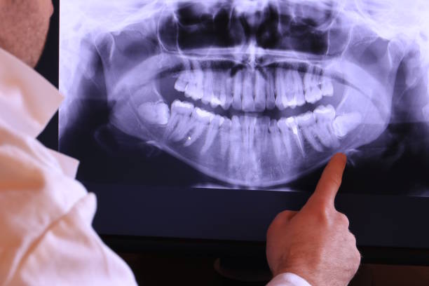 Best Orthodontic Emergency Dentist in Tavernier, FL